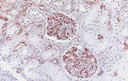 Kidney biopsy histology showing glomeruli